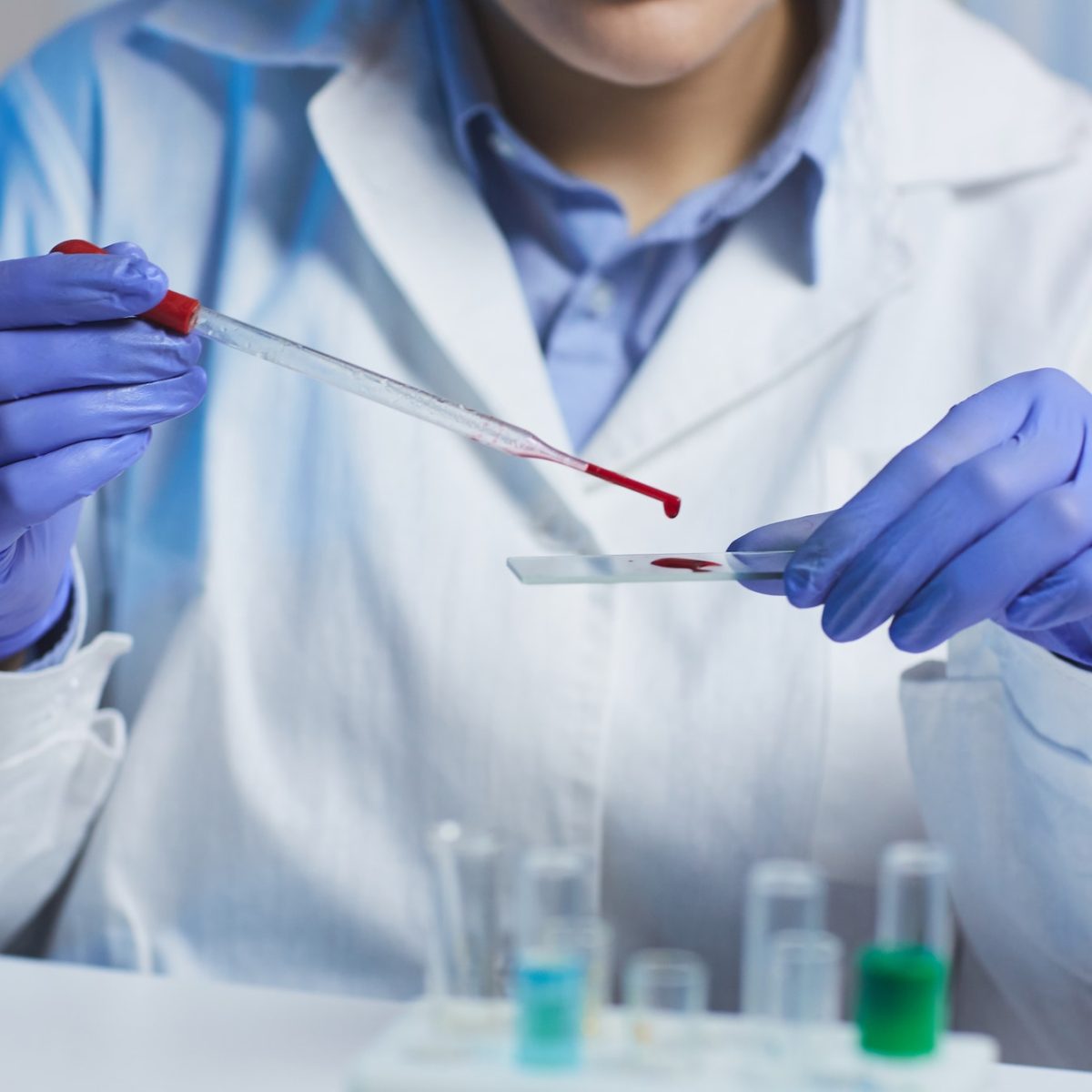 Checking sample of blood
